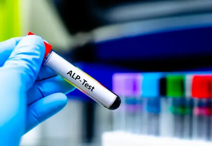 Alkaline Phosphatase Levels and Testing Methods